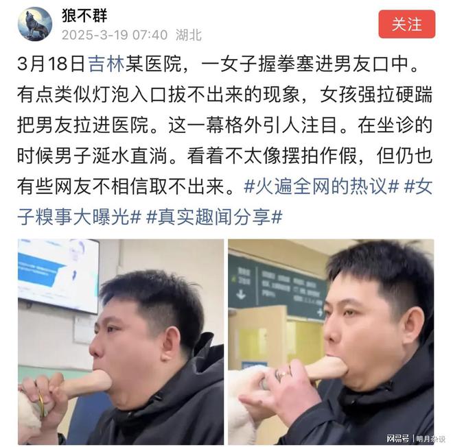 活久见！网传一男子口中被女子握拳塞进拔不出来在坐诊涎水直淌(图1)